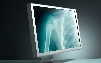 انواع رادیولوژی