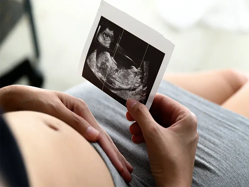 سونوگرافی NT چیست