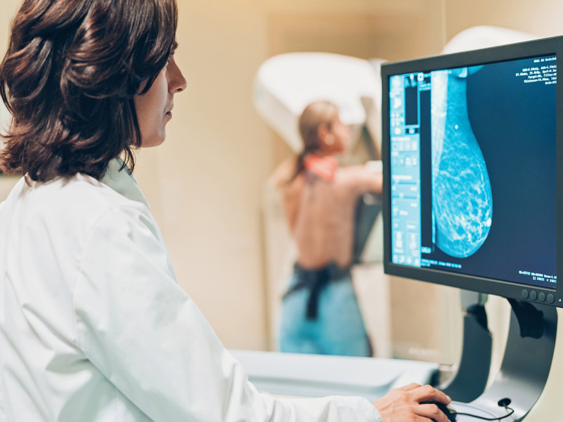 هر آنچه که در مورد ماموگرافی باید بدانید