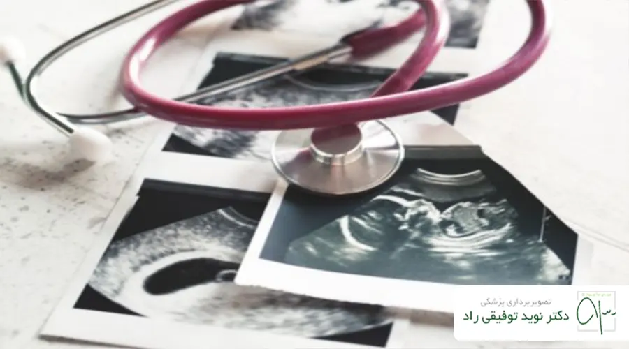 سونوگرافی ضربان قلب جنین