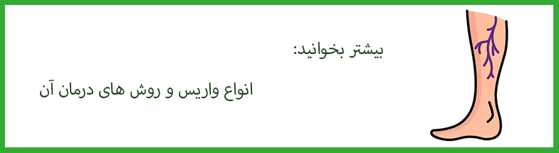 درمان واریس با اسکلروتراپی