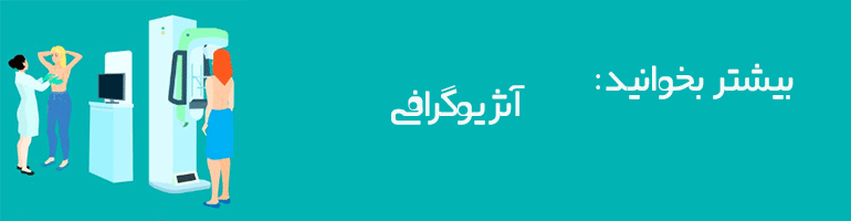 ماموگرافی چیست