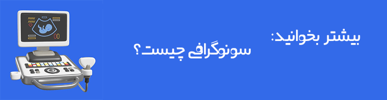 انواع سونوگرافی